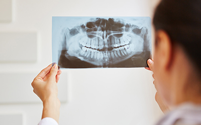 A person looking at a dental x-ray