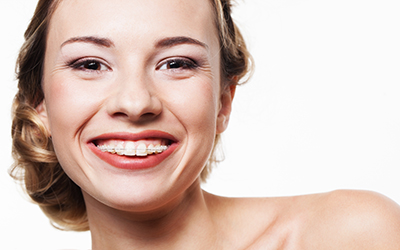 Adult woman smiling with braces.jpg