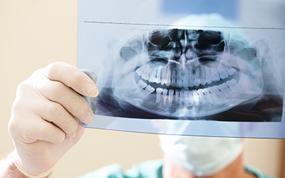 A dentist looking at a dental x-ray