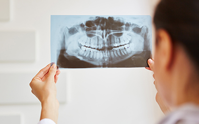 Woman reading a dental x-ray